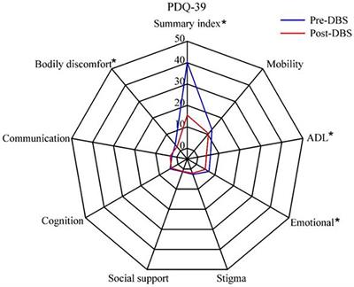 Can Levodopa Challenge Testing Predict the Effect of Deep Brain Stimulation? One-Year Outcomes in a Chinese Cohort